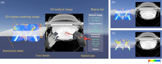 20230521-0033990威尼斯医学院博士生张楠、杨讷与李阳曦在中国生物医学工程大会暨创新医疗峰会上获奖-张楠-基于三维空间交互的宫颈癌靶区勾画虚拟现实环境总览.jpg